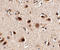 SLIT And NTRK Like Family Member 5 antibody, A10564, Boster Biological Technology, Immunohistochemistry paraffin image 