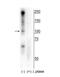 RB Binding Protein 8, Endonuclease antibody, NBP2-60769, Novus Biologicals, Western Blot image 