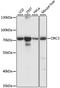 Origin Recognition Complex Subunit 3 antibody, A15415, ABclonal Technology, Western Blot image 