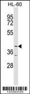 Ankyrin Repeat And BTB Domain Containing 1 antibody, 59-082, ProSci, Western Blot image 