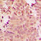 Histone Deacetylase 5 antibody, LS-C353225, Lifespan Biosciences, Immunohistochemistry frozen image 