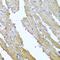 Sorcin antibody, PA5-77014, Invitrogen Antibodies, Immunohistochemistry paraffin image 