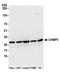 Charged Multivesicular Body Protein 3 antibody, A305-397A, Bethyl Labs, Western Blot image 