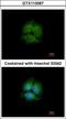 Leucine Rich Repeat Kinase 2 antibody, GTX113067, GeneTex, Immunofluorescence image 