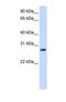 Corticosteroid 11-beta-dehydrogenase isozyme 1 antibody, NBP1-69644, Novus Biologicals, Western Blot image 