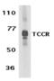 Interleukin 27 Receptor Subunit Alpha antibody, AHP1620T, Bio-Rad (formerly AbD Serotec) , Western Blot image 