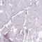 Myristoylated alanine-rich C-kinase substrate antibody, HPA069443, Atlas Antibodies, Immunohistochemistry frozen image 