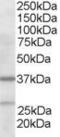 Actin Related Protein 2/3 Complex Subunit 1B antibody, STJ70178, St John