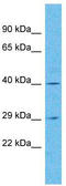 Olfactory Receptor Family 4 Subfamily N Member 5 antibody, TA337514, Origene, Western Blot image 