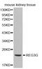 Regenerating Family Member 3 Gamma antibody, LS-B15393, Lifespan Biosciences, Western Blot image 