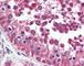 Hepatitis A Virus Cellular Receptor 1 antibody, 49-280, ProSci, Immunohistochemistry paraffin image 