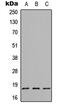 CKLF Like MARVEL Transmembrane Domain Containing 1 antibody, GTX56089, GeneTex, Western Blot image 