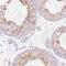 Pyridoxal Dependent Decarboxylase Domain Containing 1 antibody, NBP2-30594, Novus Biologicals, Immunohistochemistry paraffin image 