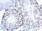 H2A Histone Family Member X antibody, GTX628789, GeneTex, Immunohistochemistry paraffin image 