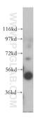 Bleomycin Hydrolase antibody, 14941-1-AP, Proteintech Group, Western Blot image 