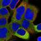 Protein Phosphatase 6 Regulatory Subunit 1 antibody, HPA063681, Atlas Antibodies, Immunofluorescence image 
