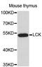 LCK Proto-Oncogene, Src Family Tyrosine Kinase antibody, abx126959, Abbexa, Western Blot image 