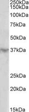 Solute Carrier Family 6 Member 12 antibody, 43-229, ProSci, Western Blot image 