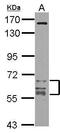 Calcium/Calmodulin Dependent Protein Kinase II Gamma antibody, GTX108304, GeneTex, Western Blot image 