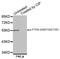 Phosphatase And Tensin Homolog antibody, abx000193, Abbexa, Western Blot image 