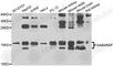GABA Type A Receptor-Associated Protein antibody, A5616, ABclonal Technology, Western Blot image 