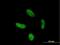 Zinc Finger Protein 287 antibody, H00057336-B01P, Novus Biologicals, Immunofluorescence image 