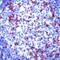 Zeta Chain Of T Cell Receptor Associated Protein Kinase 70 antibody, PA5-32644, Invitrogen Antibodies, Immunohistochemistry paraffin image 