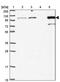 Methylenetetrahydrofolate Dehydrogenase (NADP+ Dependent) 1 Like antibody, PA5-62125, Invitrogen Antibodies, Western Blot image 