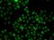 Phosphatidylinositol-4-Phosphate 5-Kinase Type 1 Alpha antibody, GTX33411, GeneTex, Immunofluorescence image 