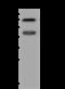 Eukaryotic Translation Initiation Factor 2D antibody, 201803-T32, Sino Biological, Western Blot image 