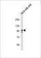 Enhancer Of Zeste 2 Polycomb Repressive Complex 2 Subunit antibody, A00050-3, Boster Biological Technology, Western Blot image 
