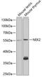 NIMA Related Kinase 2 antibody, GTX54614, GeneTex, Western Blot image 