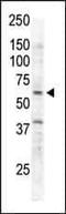 Receptor Like Tyrosine Kinase antibody, PA1-30319, Invitrogen Antibodies, Western Blot image 