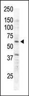 Receptor Like Tyrosine Kinase antibody, PA1-30319, Invitrogen Antibodies, Western Blot image 