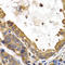 Glycogen Synthase 1 antibody, A03512-1, Boster Biological Technology, Immunohistochemistry paraffin image 