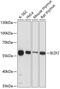 Zinc finger protein Helios antibody, GTX64570, GeneTex, Western Blot image 