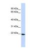 Transmembrane P24 Trafficking Protein 1 antibody, NBP1-62557, Novus Biologicals, Western Blot image 