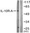 Interleukin 10 Receptor Subunit Alpha antibody, LS-C117958, Lifespan Biosciences, Western Blot image 