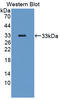 Transient Receptor Potential Cation Channel Subfamily V Member 2 antibody, LS-C373410, Lifespan Biosciences, Western Blot image 