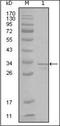 Fyn Related Src Family Tyrosine Kinase antibody, orb89390, Biorbyt, Western Blot image 