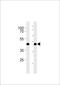 G Protein-Coupled Receptor 68 antibody, TA328194, Origene, Western Blot image 