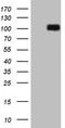 Dishevelled Segment Polarity Protein 2 antibody, LS-C798345, Lifespan Biosciences, Western Blot image 