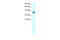 GA Binding Protein Transcription Factor Subunit Beta 1 antibody, 31-227, ProSci, Western Blot image 