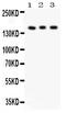Insulin Receptor antibody, LS-C312781, Lifespan Biosciences, Western Blot image 