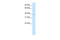 MANSC Domain Containing 1 antibody, 28-062, ProSci, Western Blot image 