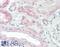Ring Finger Protein 7 antibody, 42-275, ProSci, Western Blot image 