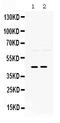 Paired Box 2 antibody, PB9734, Boster Biological Technology, Western Blot image 