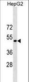 ST6 Beta-Galactoside Alpha-2,6-Sialyltransferase 1 antibody, LS-B10696, Lifespan Biosciences, Western Blot image 