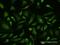 Voltage Dependent Anion Channel 1 antibody, H00007416-M17, Novus Biologicals, Immunofluorescence image 