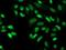 Cyclin Dependent Kinase 2 antibody, NBP2-00776, Novus Biologicals, Immunocytochemistry image 